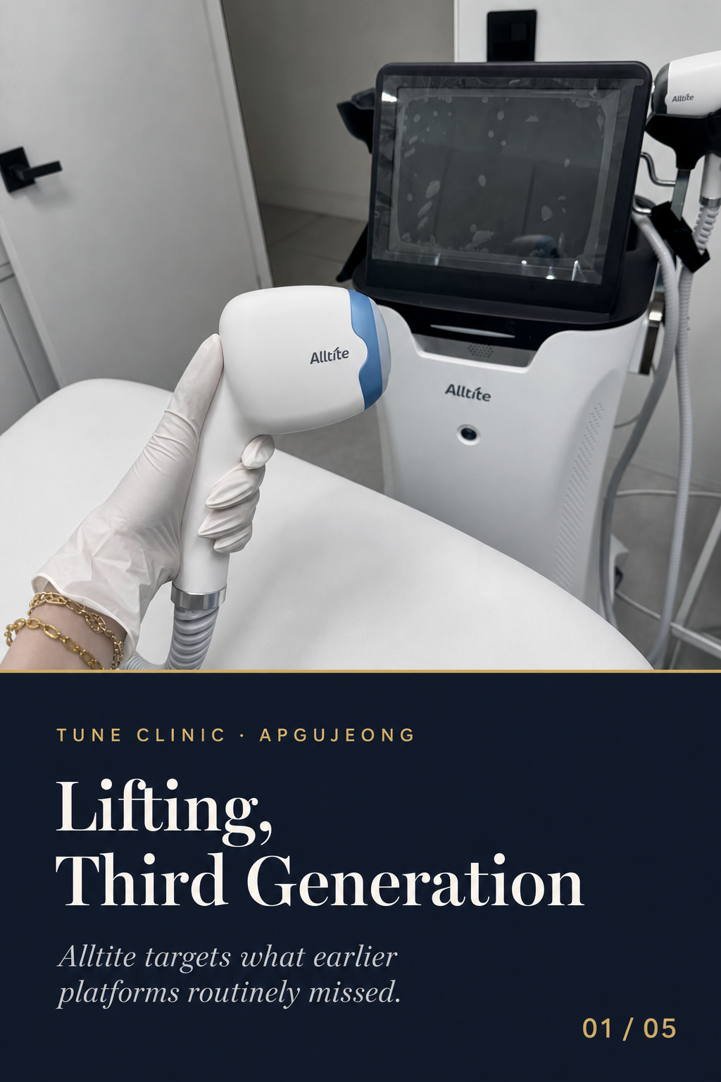Lifting, Third Generation — Alltite targets what earlier platforms routinely missed.