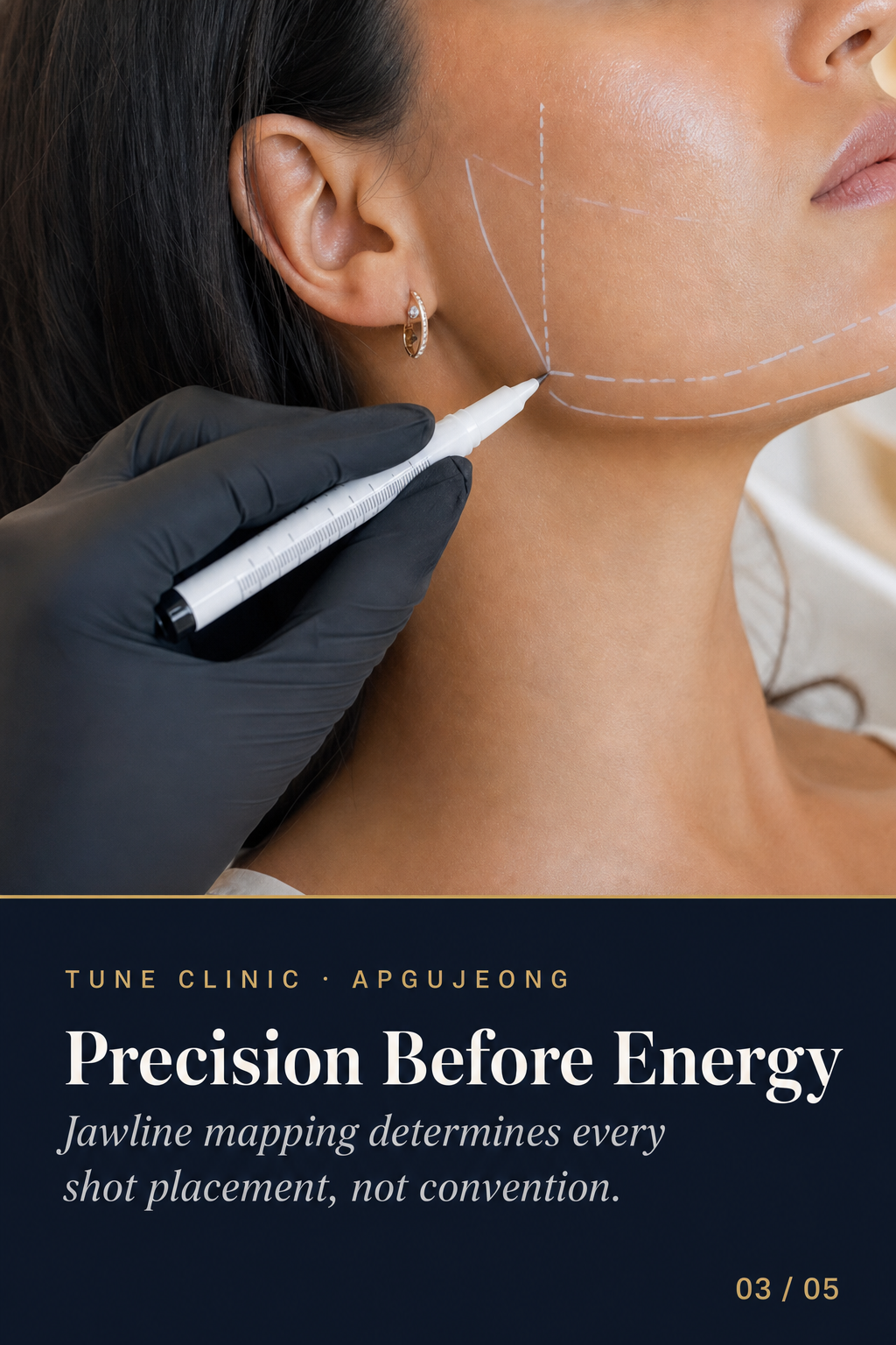 Precision Before Energy — Jawline mapping determines every shot placement, not convention.