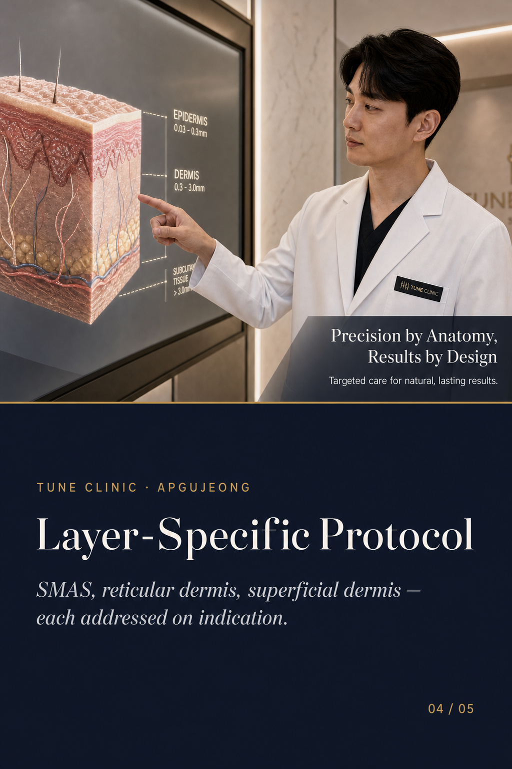 Layer-Specific Protocol — SMAS, reticular dermis, superficial dermis — each addressed on indication.