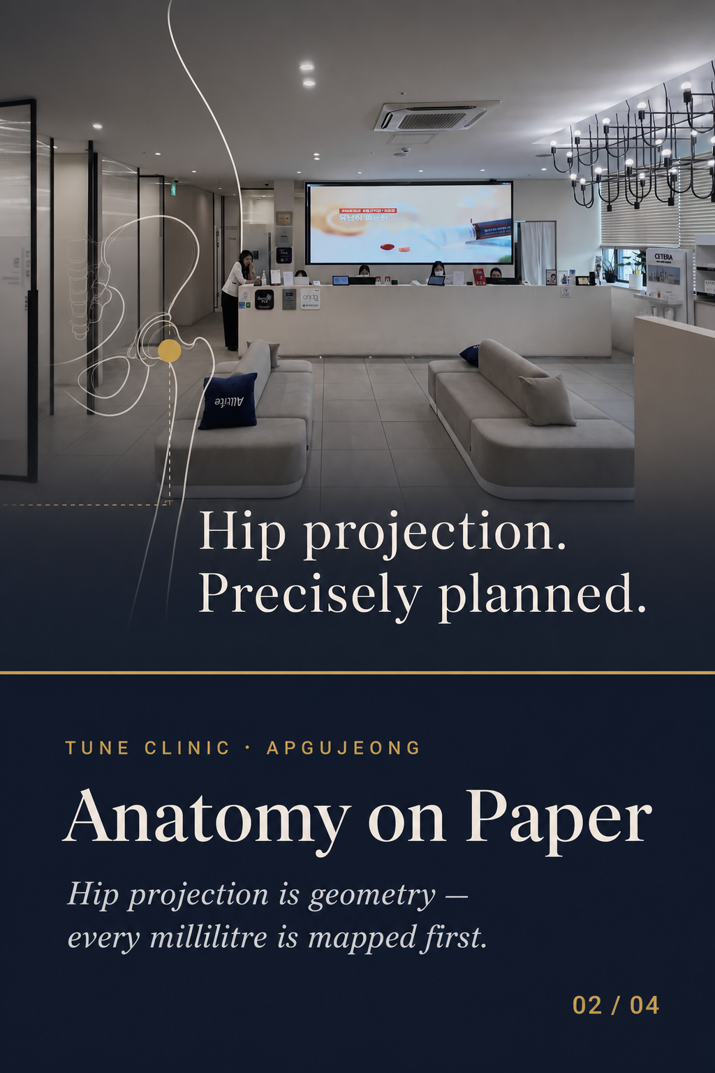 Anatomy on Paper — Hip projection is geometry — every millilitre is mapped first.