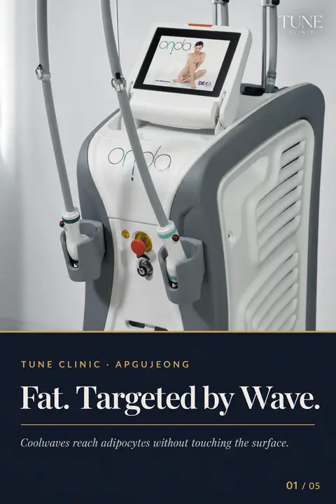 Onda Coolwaves: Microwave Fat Reduction Without Downtime