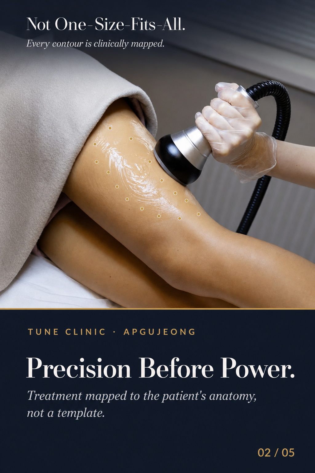 Precision Before Power. — Treatment mapped to the patient's anatomy, not a template.
