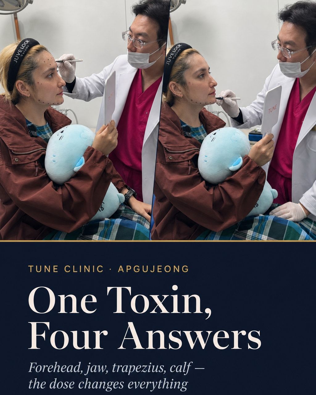 One Toxin, Four Answers — Forehead, jaw, trapezius, calf — the dose changes everything