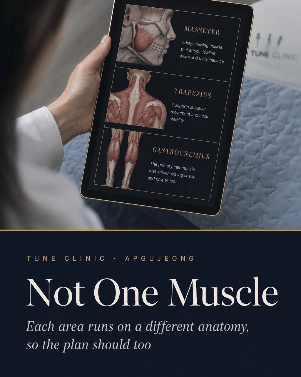 Not One Muscle — Each area runs on a different anatomy, so the plan should too
