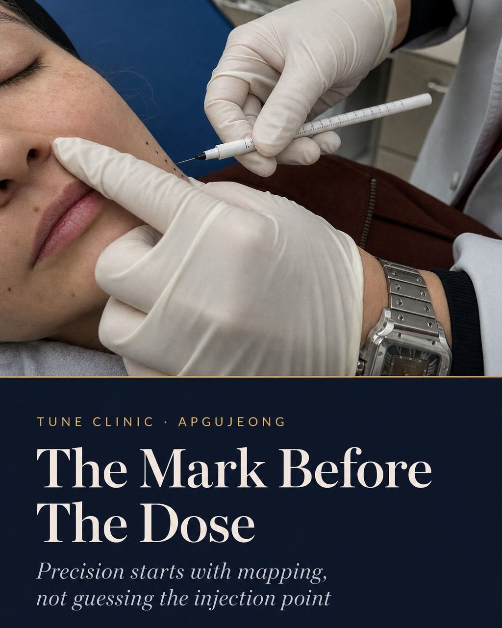 The Mark Before The Dose — Precision starts with mapping, not guessing the injection point