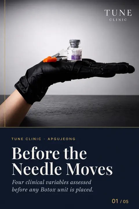 What Physicians Assess Before Placing a Single Botox Unit